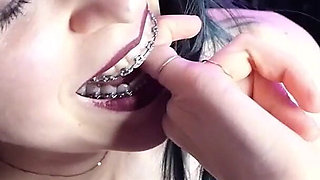 Biting My Fingers - Bite, Mouth, Teeth, Braces, Fetish Ita