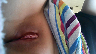 18 year old amputee girl touches her smooth innocent cleft