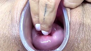 Japanese Wife Open Cervix Wide to watch inside Uterus