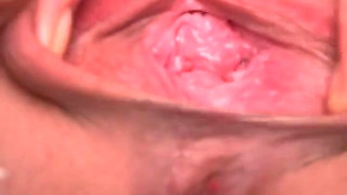 Sklavins Stabbed Her Labia