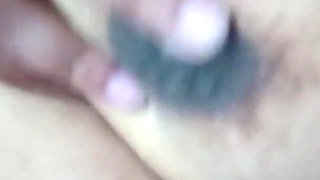 Nipples